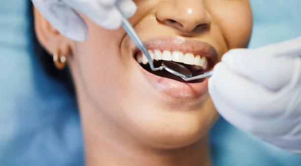 Best Teeth Whitening  in Landover Hills, MD