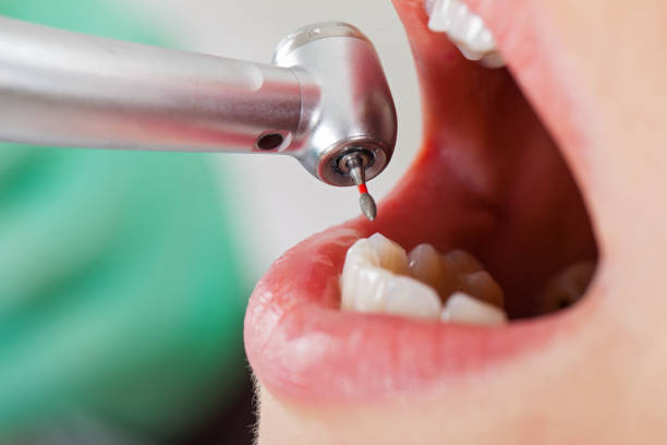 Best Emergency Tooth Extraction  in Landover Hills, MD